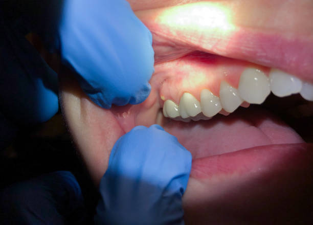 Best Emergency TMJ Treatment in Kewaunee, WI